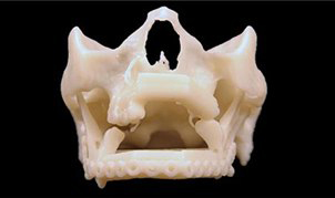 仁心仁术和3D打印技术帮助布拉辛马克维拉重新绽放笑容