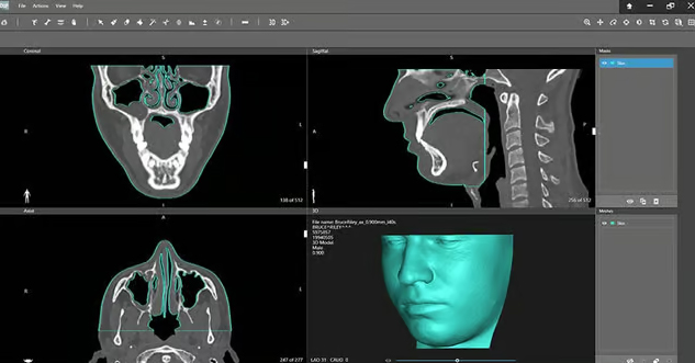 3D Systems与Klarity合作，拓展3D打印在放射治疗患者中的创新应用